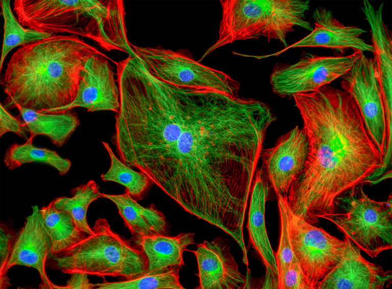 photo mitochondries - AtremoPlus L-Dopa naturelle: pourquoi elle donne plus d'énergie?